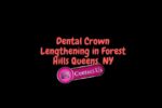 Dental Crown Lengthening in Forest Hills Queens, NY