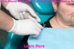What You Should Know About Partial Dentures